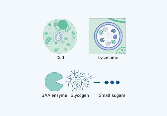 NB Cell Lysosome Gaa