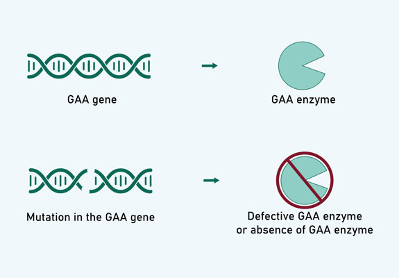 GAA Mutation