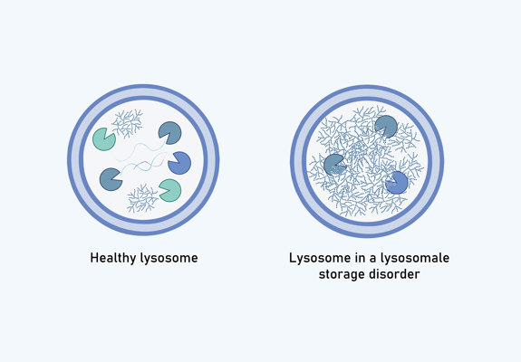 Lysosome Storage Disorder